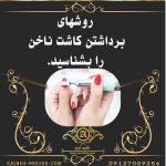 روشهای برداشتن کاشت ناخن